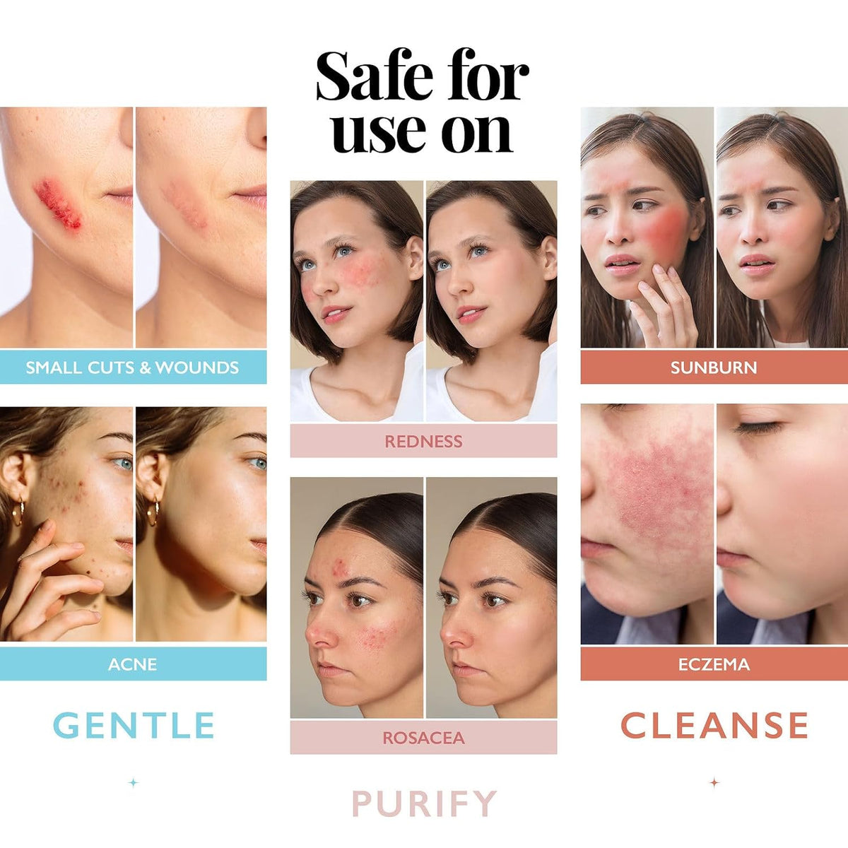 Hypochlorous Acid Spray for Face and Skin; Facial Cleanser | 8oz Face Mist