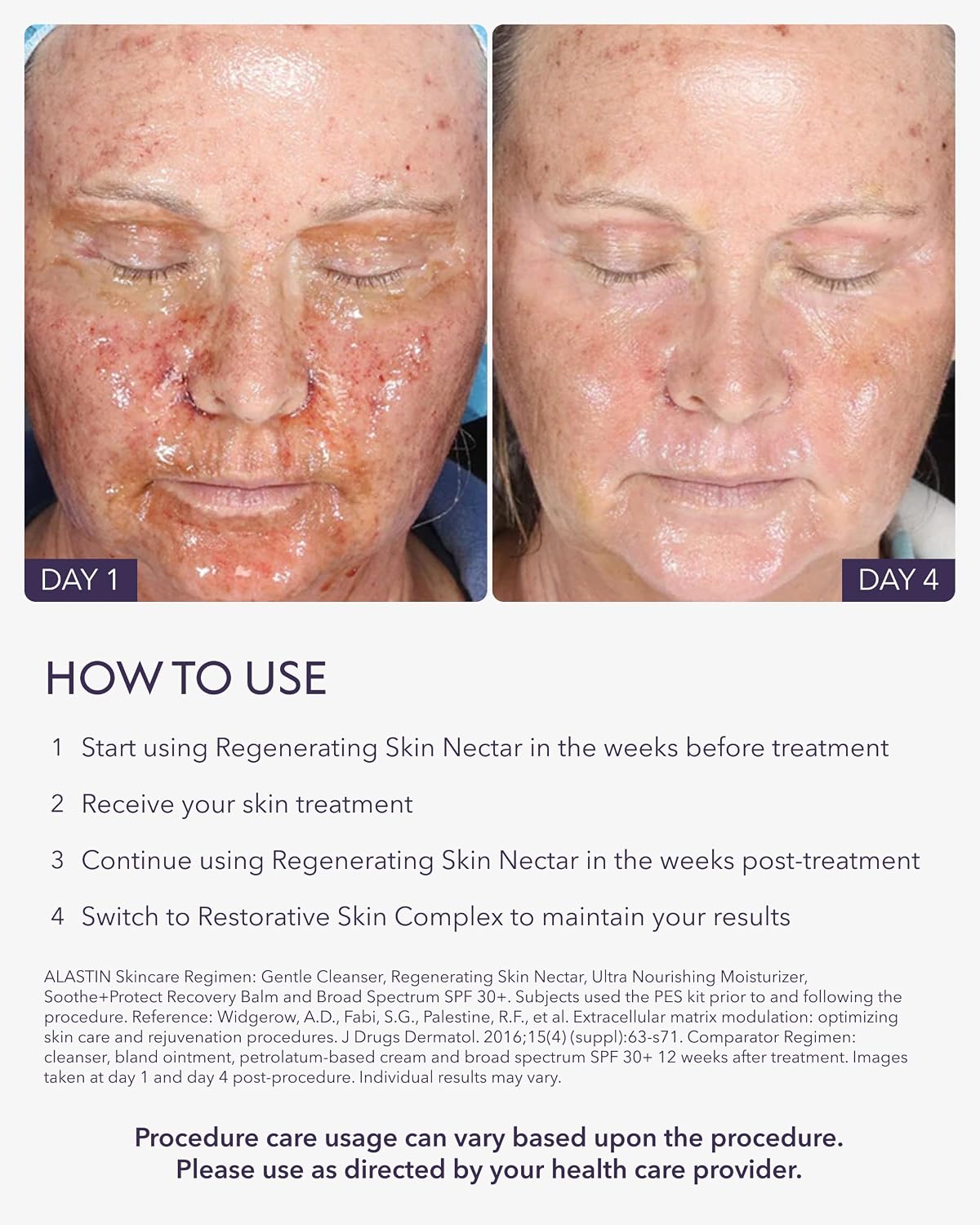 ALASTIN Skincare Regenerating Skin Nectar Face Moisturizer (1 oz)