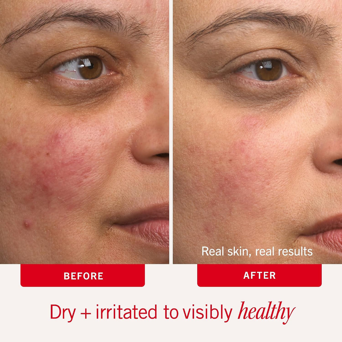 First Aid Beauty Ultra Repair Cream, Face Body Barrier Repair Moisturizer